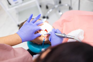 Diş tedavi prosedüründe diş hekimliği ofisinde hasta dişleri için diş matkap kullanımının yakın çekimi