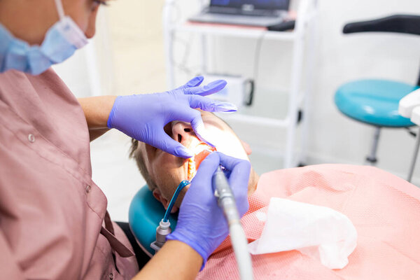 Professional dentist woman inspects patient teeth with dental tools - mirror and probe
