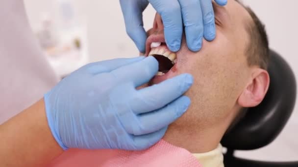 Dentysta Przyjęcie Ortodonty Polerowanie Wiązanie Żelowe — Wideo stockowe
