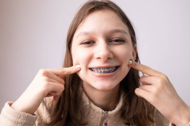 Anormal diş pozisyonu ve metal telleri olan genç bir kız. Ağzını aç, kapat..