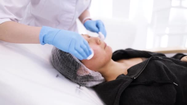 Cleaning Face Beauty Spa Peeling Procedure Woman Patient Cosmetology Clinic — Vídeos de Stock