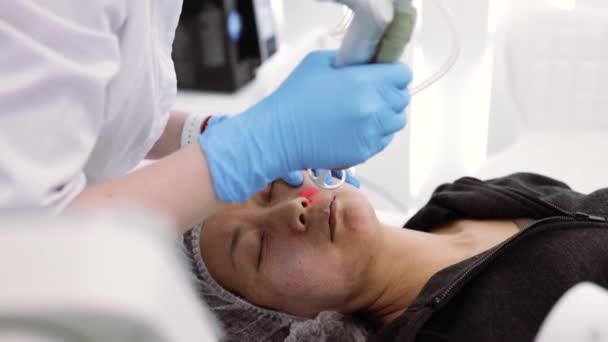 Frakční Laserový Co2 Zákrok Kosmetická Léčba Kosmetické Klinice Žena Laserovým — Stock video