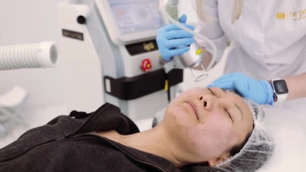 Дробная Лазерная Процедура Co2 Косметическое Лечение Клинике Красоты Женщина Проходящая — стоковое видео