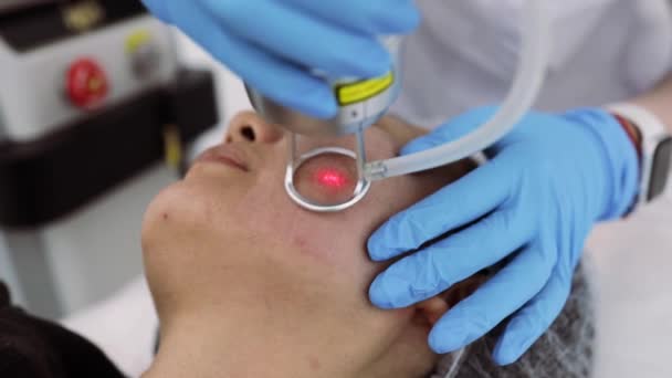 Procédure Fractionnement Laser Co2 Traitement Cosmétique Clinique Beauté Femme Ayant — Video