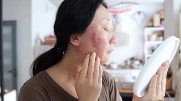 Лицо Азиатской Женщины Которая Прошла Курс Лечения Кожи Лица Препаратом — стоковое видео