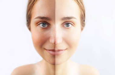 Güzel bir kadın, yarı bronzlaşmış yüzüyle gülümseyen bir kız beyaz stüdyo arka planında. Güneş kreminden önce ve sonra kadın derisi, güneş kremi. Sağlık, tatil, güneş kremi ve güneş kremi kavramı