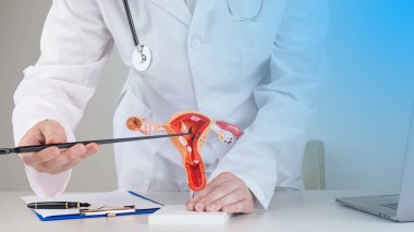 Doktor jinekolog masaüstünde kadın üreme sisteminin modelini gösteriyor.