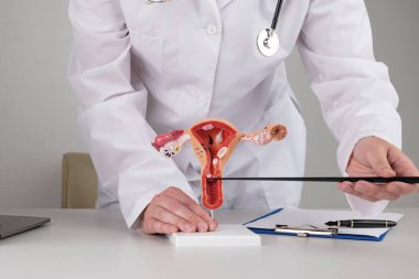 Doktor jinekolog masaüstünde kadın üreme sisteminin modelini gösteriyor.