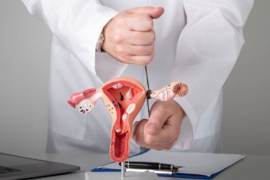 Jinekolog, dölyatağı borularını kadın üreme sisteminin eğitim modeline nasıl bağlayacağını gösteriyor.