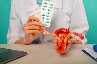 Doktor örnek dişi üreme organları ve hapları yakın planda tutuyor. Koruma, tedavi, önleme kavramı.