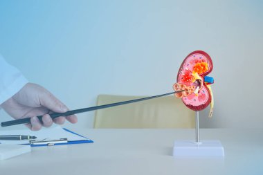 Doktor nefrolog, masaüstündeki bir böbrek modeline polisistiği işaret ediyor.