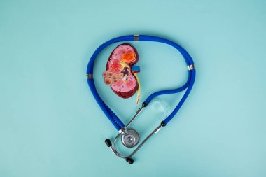 Model böbrek ve steteskop mavi arka planda yatıyor.