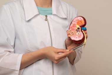 Doktor nefrolog, anatomik böbrek modeline işaret ediyor..