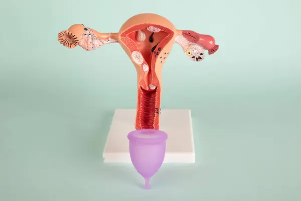 stock image mockup of female reproductive system and pink menstrual cup on blue background. Concept of a novelty of a medical vaginal bowl for discharge during menstruation in a girl.