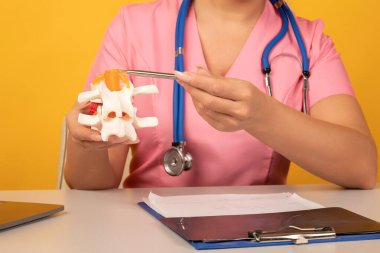 Tıbbi klinikte danışmanlık yaparken doktor elinde anatomik bel fıtığı modeli var. Omurgalar arası fıtık tedavisi