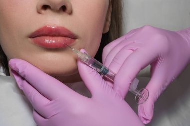 Bir kozmetoloji salonunda dudak büyütme ve düzeltme prosedürü. Uzman hastaların dudaklarına iğne yapıyor. Yüksek kalite fotoğraf