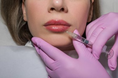 Dudaklarına botoks yaptıran bir kadının portresi yakın plan. Güzel bir kadın yüzüne botoks yaptırıyor. Yetişkin bir kız klinikte botoks yaptırıyor. Güzellik tedavileri