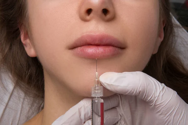 Botox Injekció Beadását Végző Kozmetikus Kezeinek Közelsége Női Ajkakon Fecskendő — Stock Fotó