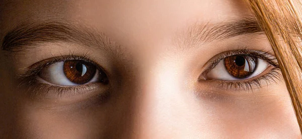 Strabismus Close Part Childs Face Eyes Girl Little Patient Strabismus —  Fotos de Stock