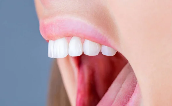 Zahnaufhellung Zahngesundheit Konzept Zahnaufhellungsverfahren Zahnpflege Zahnmedizinisches Konzept Perfekt Gesunde Zähne — Stockfoto