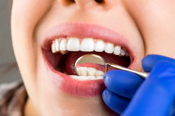 Dental care, taking care of teeth. Girl having teeth examined at dentists. Woman in stomatology clinic with dentist. Healthy teeth concept. Taking care of teeth. Woman at the dentist.