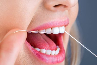 Teeths Flossing. Oral hygiene and health care. Smiling women use dental floss white healthy teeth. Dental flush - woman flossing teeth. Dental floss. Taking care of teeth. Healthy teeth concept.