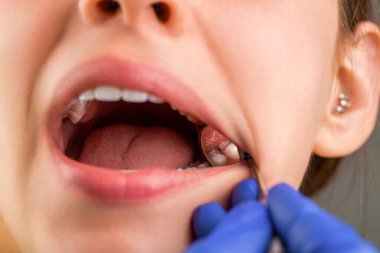 Dişçiyle stomatoloji kliniğinde çalışan bir kadın. Sağlıklı diş kavramı. Dişlerine bakıyorum. Dişçideki kadın. Diş bakımı, diş bakımı. Diş hekimlerine muayene olan bir kız..