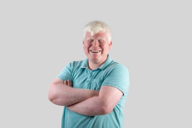 Gri arka planda izole edilmiş gülümseyen albino adamın portresi. Yüksek kalite fotoğraf