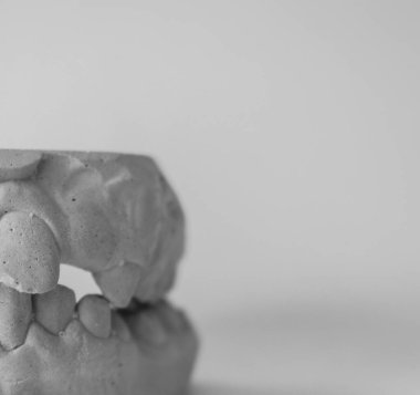 Diş macunu kalıbı, ortodontik aygıt üretimi için. Çocuk ortodonti. Projeniz için kalite kalıbı