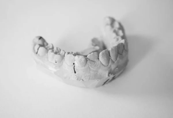 Dental plaster cast of teeth for the manufacture of orthodontic apparatus. Children's orthodontics. Quality image for your project