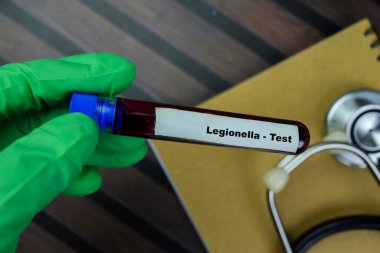 Lejyonella kavramı kan örneğiyle test edilir. Sağlık hizmetleri ya da tıbbi konsept