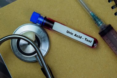 Concept of Uric Acid - Test with blood sample. Healthcare or medical concept clipart