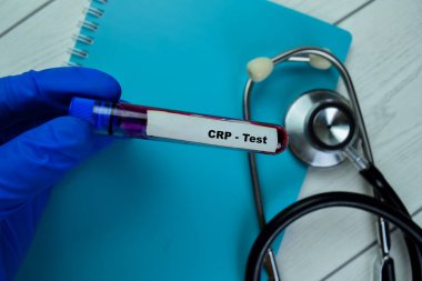 CRP kavramı - kan örneğiyle test edin. Sağlık hizmetleri ya da tıbbi konsept