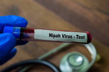 Nipah Virüsü, kan örneğiyle test edin. Ahşap arka planda izole edilmiş. Sağlık hizmetleri ya da tıbbi konsept