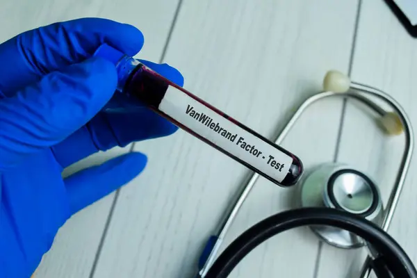 VonWilebrand Factor - Test with blood sample on wooden background. Healthcare or medical concept