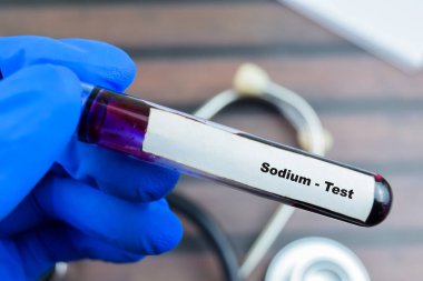 Sodyum - Tahta arka planda kan örneği ile test edin. Sağlık hizmetleri ya da tıbbi konsept