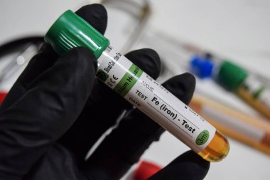 Fe Iron - Test with blood sample. Top view isolated on office desk. Healthcare or Medical concept
