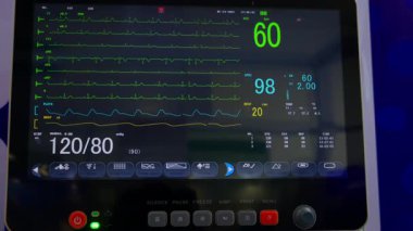 Kritik bakım izleme ünitesinin odadaki gösterimi, ekranda nabız ve oksijen seviyelerini gösterme yeteneğini vurguluyor.