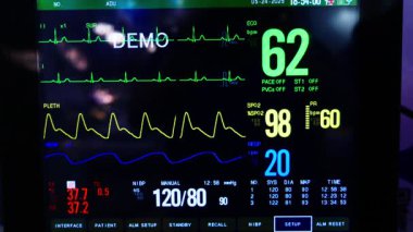 Gösterinin yakın çekim görüntüsü, darbe hızı, oksijen ve diğer parametreleri etkin bir şekilde gösteren kritik bakım izleme ünitesini ortaya koymaktadır..