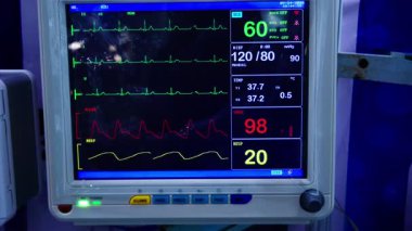 Kritik bakım ünitesinin bir göstergesi ekranda nabız, oksijen ve diğer hayati parametreleri gösterme yeteneğini gösteriyor.