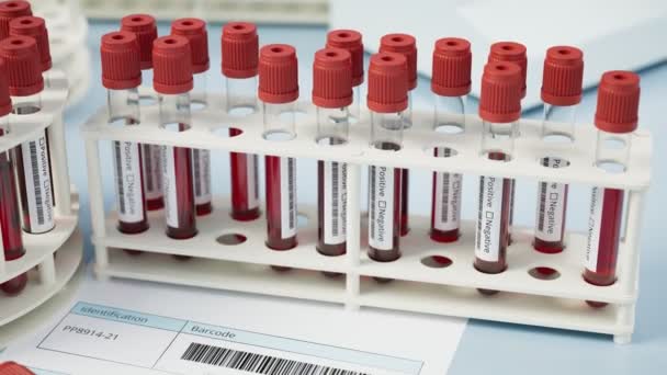 Kanlı Test Tüpleri Pozitif Sonuç Hastalık Ölümcül Virüs Tespit Edildi — Stok video