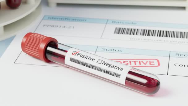 Rör Testat Blod Positivt Resultat Sjukdom Dödligt Virus Upptäckt Hiv — Stockvideo