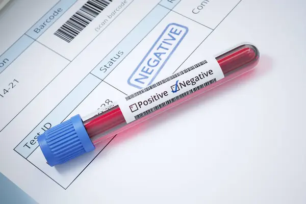Tube Blood Medical Documents Negative Result Test Lethal Virus Detection — Stock Photo, Image