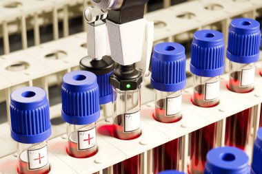 Yüksek hassasiyetli otomatik kan testi ekipmanları, modern bir klinik laboratuvar ortamında çoklu kan tüplerini ustalıkla işlemek ve analiz etmek.