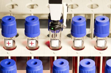 Gelişmiş otomatikleştirilmiş kan testi makinelerinin yakın görüntüsü, hassas pipetleme sisteminin altını çizmek ve titizlikle etiketlenmiş örnek şişeleri, modern teşhis prosedürlerinin merkezi.