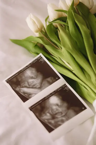 Ultrason resmi beyaz lale buketinin yanında duruyor. Hamile konsepti, anne sağlığı.
