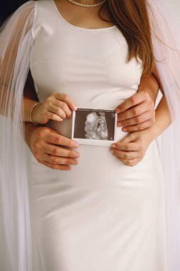 Beyaz elbiseli hamile bir kadın ve hamile karnının yanında ultrason fotoğrafı tutan kocası. Aile kavramı. Mutlu ebeveynlik kavramı.