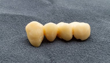 Gri arka planda geçici diş köprüsü izole edildi. Geçici reçine dişleri. Diş sağlığı ve implant konsepti