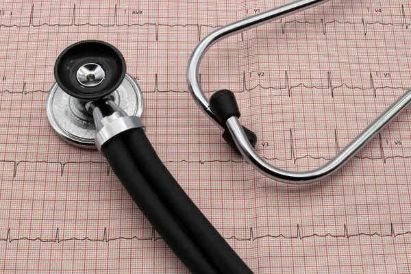 stock image Stethoscope on electrocardiogram in paper form. Heart disease treatment and prevention.