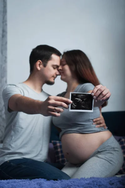 赤ちゃんを期待して愛するカップルは超音波スキャンを保持しています — ストック写真